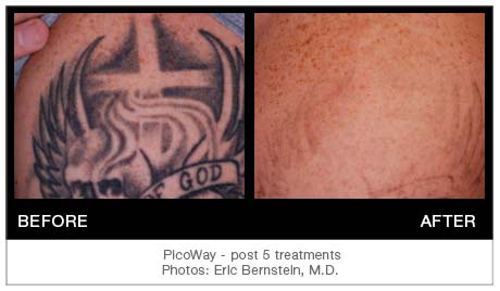 picoway-tattoo-Bernstein-002